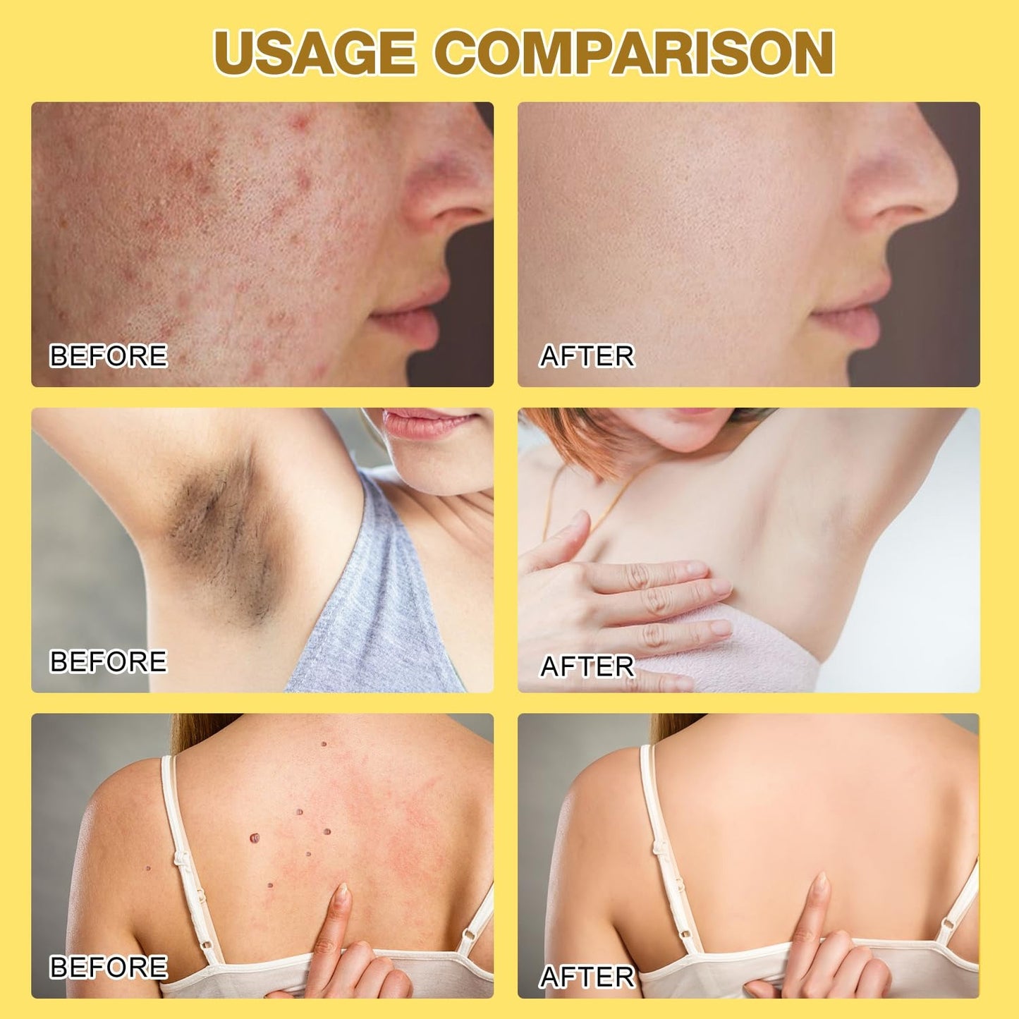 Bee Venom Skin Treatment Cream