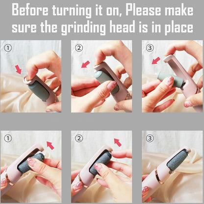 Callus Remover for Feet